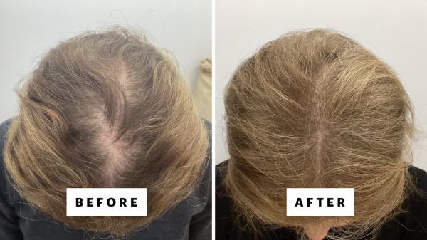 Image may contain Adult Person Hair Head Face and Ponytail