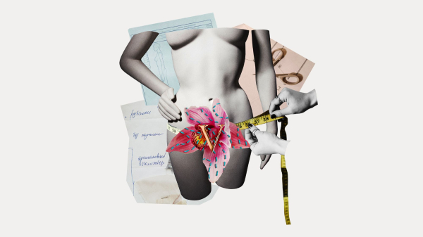 My Labiaplasty Was About More Than Just Getting a “Designer Vagina”