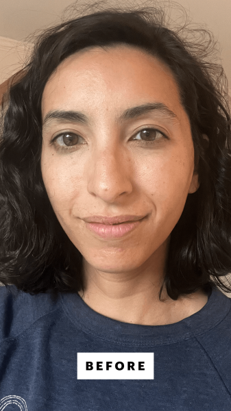 Pai before applying Paulas Choice Skin Perfecting 2 BHA Liquid Exfoliant